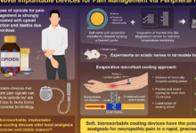 研究人员开发出可生物吸收的可植入装置以阻断来自周围神经的疼痛信号