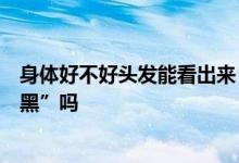 身体好不好头发能看出来？缺啥营养会长白发？白发可“转黑”吗