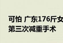 可怕 广东176斤女子每天奶茶不离手准备做第三次减重手术