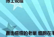 博士说痘||直击痘痘的老巢 细胞在毛囊漏斗部变身痘痘——细说细胞祛痘之四