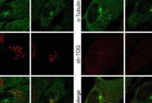 科学家发现chTOG蛋白对于构建和维持细胞骨架至关重要
