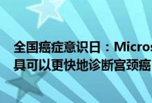 全国癌症意识日：Microsoft和SRL Diagnostics宣布AI工具可以更快地诊断宫颈癌