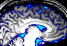 科学家触发清醒大脑中的脊髓液流动