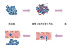 发现转移性癌细胞使用的分子途径