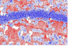 科学家查明完整组织和单细胞中数千种蛋白质的生成位置