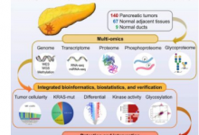 大规模多组学研究揭示胰腺癌特征