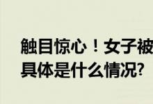 触目惊心！女子被狗撕碎左脸缝了500多针 具体是什么情况?