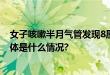 女子咳嗽半月气管发现8厘米蚂蟥医生：或因喝生水所致 具体是什么情况?