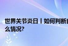 世界关节炎日丨如何判断自己是否患上了关节炎？ 具体是什么情况?