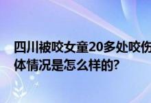 四川被咬女童20多处咬伤 会诊医生：丢肾的概率非常高 具体情况是怎么样的?