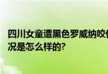 四川女童遭黑色罗威纳咬伤最新消息：犬主人被刑拘 具体情况是怎么样的?