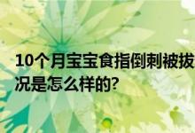 10个月宝宝食指倒刺被拔送PICU抢救 心肺功能衰竭 具体情况是怎么样的?