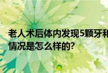 老人术后体内发现5颗牙和牙套 给老人带来致命性伤害 具体情况是怎么样的?