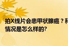 拍X线片会患甲状腺癌？科普来了 甲状腺癌能治愈吗？ 具体情况是怎么样的?