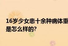 16岁少女患十余种病体重22斤 存在重度营养不良 具体情况是怎么样的?