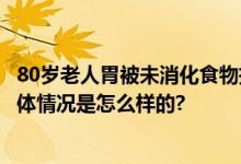 80岁老人胃被未消化食物撑大2倍 自称不想给儿女添麻烦 具体情况是怎么样的?