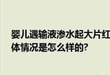 婴儿遇输液渗水起大片红肿水泡 网友：当爸妈后看不得 具体情况是怎么样的?