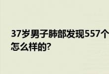 37岁男子肺部发现557个结节 医生也大为震撼 具体情况是怎么样的?