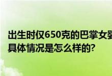 出生时仅650克的巴掌女婴出院了 妈妈：医护给了二次生命 具体情况是怎么样的?