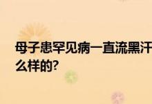 母子患罕见病一直流黑汗 网友：第一次听说 具体情况是怎么样的?