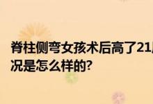 脊柱侧弯女孩术后高了21厘米 从1米22矫形至1米43 具体情况是怎么样的?