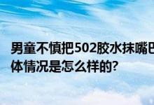 男童不慎把502胶水抹嘴巴胳膊上 妈妈：幸好胶水没入眼 具体情况是怎么样的?