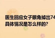 医生回应女子眼角掉出74根眼睫毛 当事人：还以为是虫子 具体情况是怎么样的?