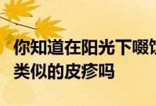 你知道在阳光下啜饮玛格丽塔或吃橘子会导致类似的皮疹吗